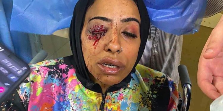 اعتدي عليها بالضرب عند تحصيلها قسط مالي 